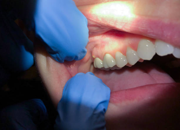 Best Walk-In Emergency Dentist in Socorro, TX