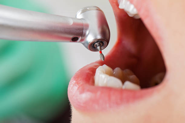 Best After-Hours Emergency Dentist in Socorro, TX